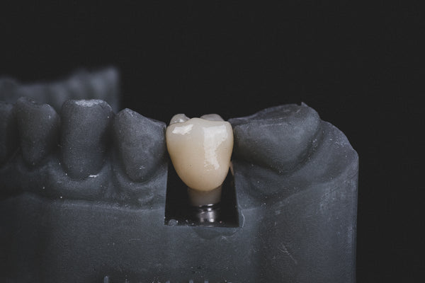 danties implanto maketas